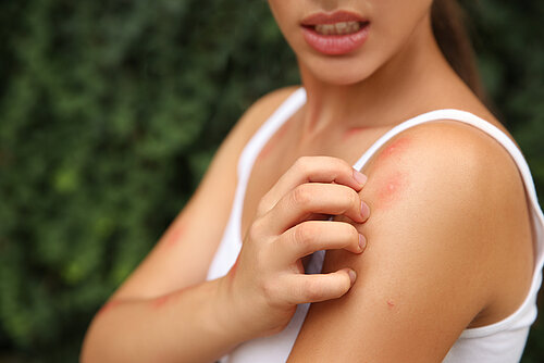 Woman in white tank top scratching red irritated skin patches on her shoulder and arm outdoors near green foliage